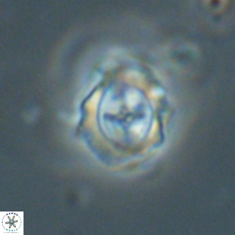 Campylosphaera cf eodela 68377