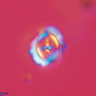 Campylosphaera cf eodela 68379