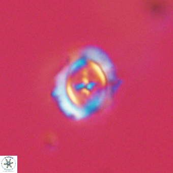 Campylosphaera cf eodela 68379