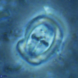 Campylosphaera dela VR 02402