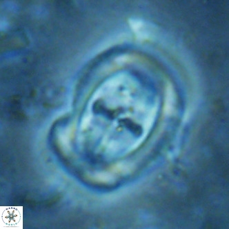 Campylosphaera dela VR 02402