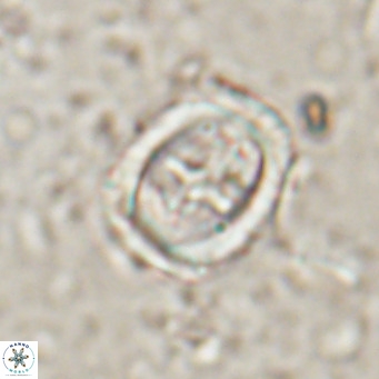 Campylosphaera dela VR 025341