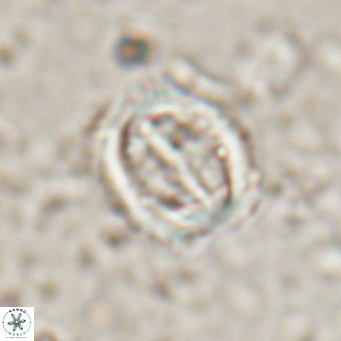 Campylosphaera dela VR 025344
