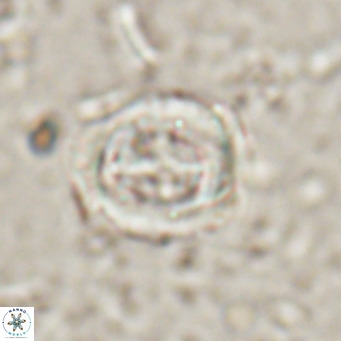 Campylosphaera dela VR 025345