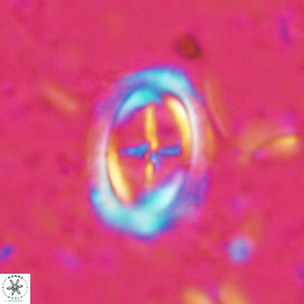 Campylosphaera dela VR 025330