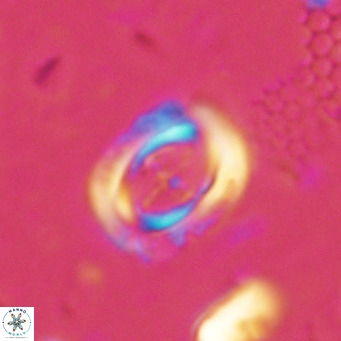 Campylosphaera dela VR 03049