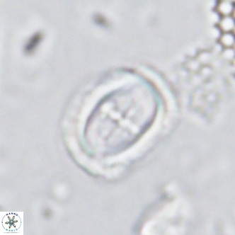 Campylosphaera dela VR 03050