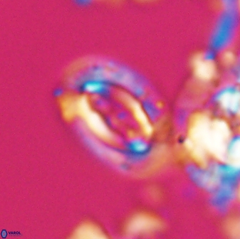 Campylosphaera eodela 22622