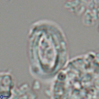 Campylosphaera eodela 22625