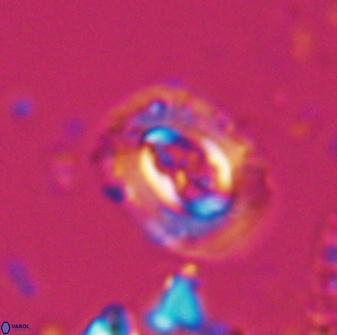 Campylosphaera eodela 25981