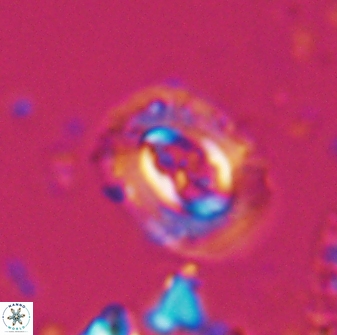 Campylosphaera eodela 25981