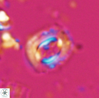 Campylosphaera eodela 25984