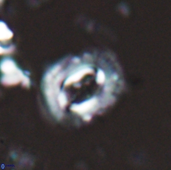 Campylosphaera eodela 25985