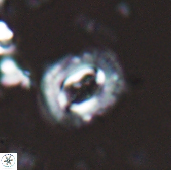 Campylosphaera eodela 25985