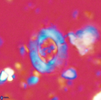 Campylosphaera eodela 42976