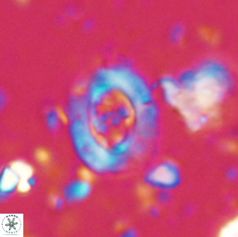 Campylosphaera eodela 42976