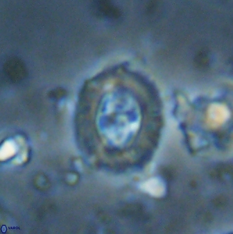 Campylosphaera eodela 42985