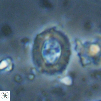 Campylosphaera eodela 42985