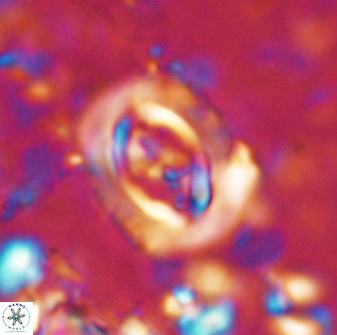 Campylosphaera eodela 42995