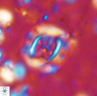 Campylosphaera eodela 42997