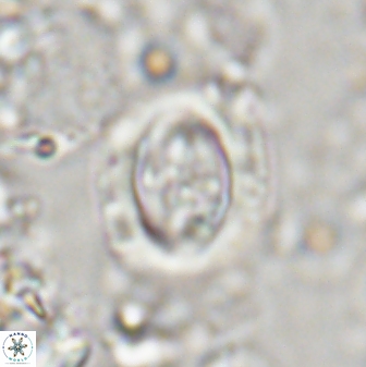 Campylosphaera eodela 43000