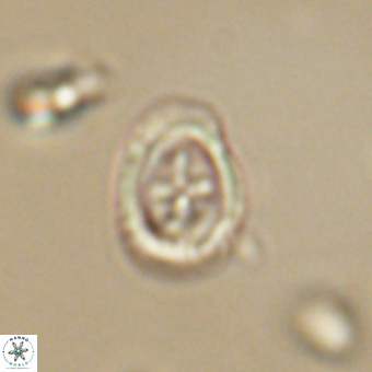 Campylosphaera eodela 68546