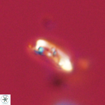 Campylosphaera eodela 68392