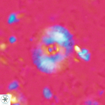 Campylosphaera eroskayii VR 025418