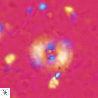 Campylosphaera eroskayii VR 025425