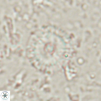 Campylosphaera eroskayii VR 025428