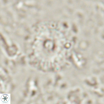 Campylosphaera eroskayii VR 025429