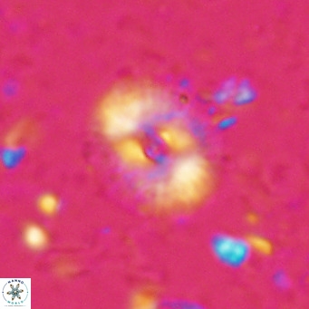 Campylosphaera eroskayii VR 025420