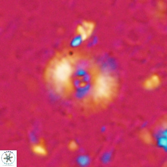 Campylosphaera eroskayii VR 025422
