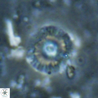 Campylosphaera eroskayii VR 025435