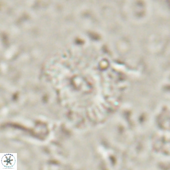 Campylosphaera eroskayii VR 025430