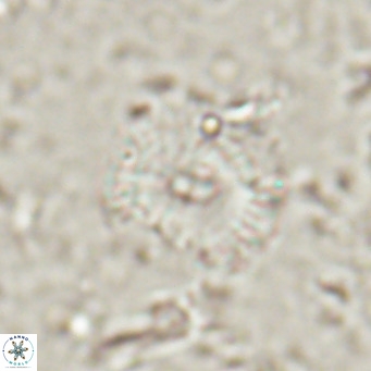 Campylosphaera eroskayii VR 025431