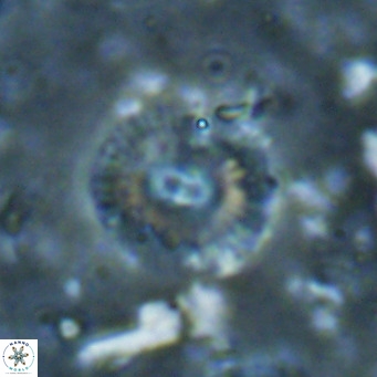 Campylosphaera eroskayii VR 025432