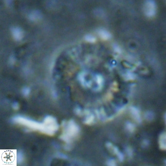 Campylosphaera eroskayii VR 025433