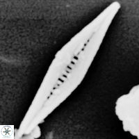 Calciosalenia fossilis 3 55mic Tetepare 200 1