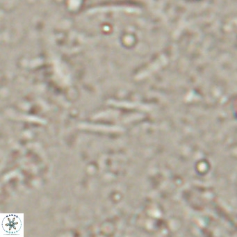 Calciosolenia alternans VR 025015