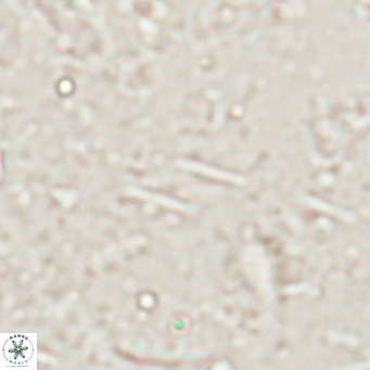 Calciosolenia alternans VR 025017