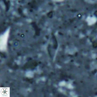 Calciosolenia alternans VR 025019