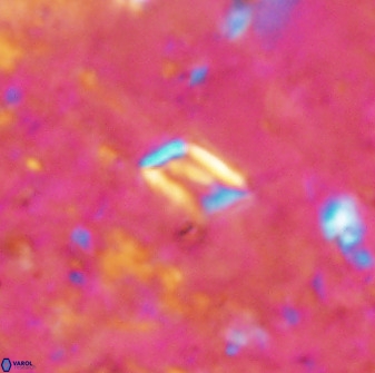 Calciosolenia aperta 49576
