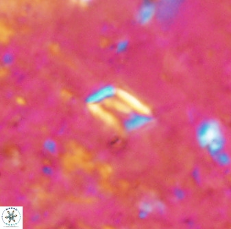 Calciosolenia aperta 49576