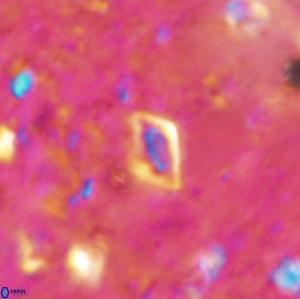 Calciosolenia aperta 49577