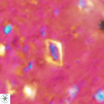 Calciosolenia aperta 49577