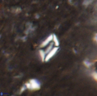 Calciosolenia aperta 49579