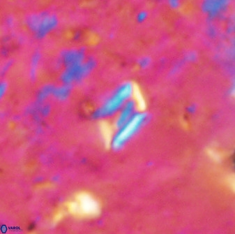 Calciosolenia aperta 49580