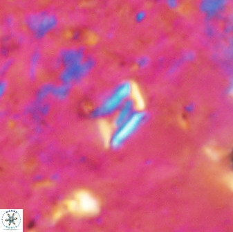Calciosolenia aperta 49580