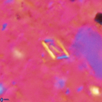 Calciosolenia aperta 49511
